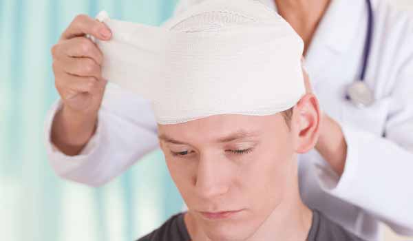 الرأس… ما مدى خطورة إصابات الرأس وكيفية التعامل معها؟