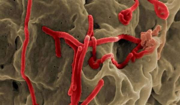 حمى إيبولا النزفية