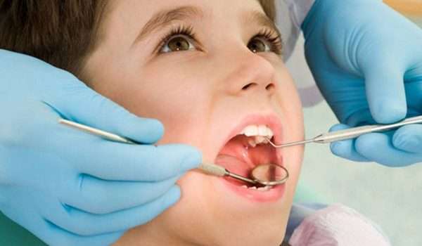 اصابات الاسنان Dental injuries