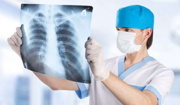 التليف الرئوي Pulmonary fibrosis