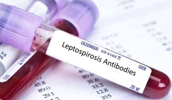داء البريميات Leptospirosis