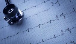 رسم القلب أو تخطيط القلب الكهربائي