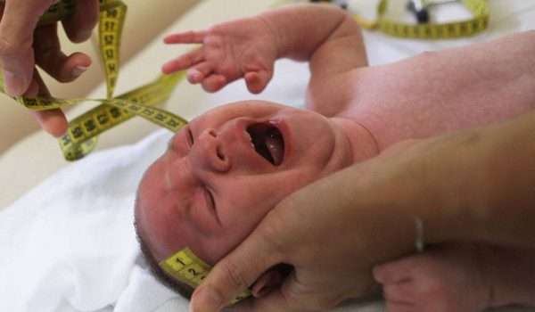 ولادة أول طفل مصاب بتشوهات فيروس زيكا في أوروبا