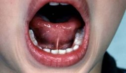 تعرفى على اسرار جاذبية الفم؟ – اختبرى نفسك