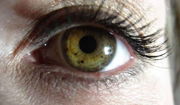 بقع قزحية العين قد تكون علامة على أمراض تسببها الشمس!