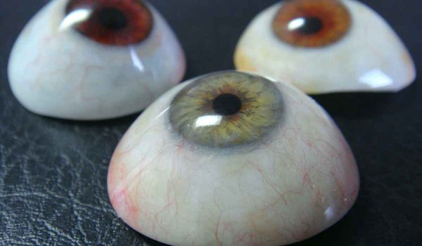 زراعة العين الاصطناعية