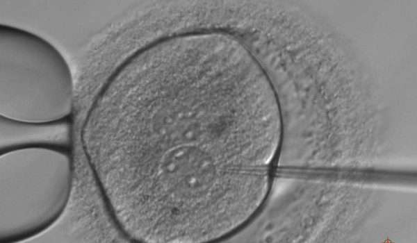 علماء يقومون بـ التعديل الجيني للأجنة البشرية ويكتشفون السبب وراء الإجهاض