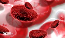 ابيضاض الدم النقوي المزمن Chronic myelogenous leukemia