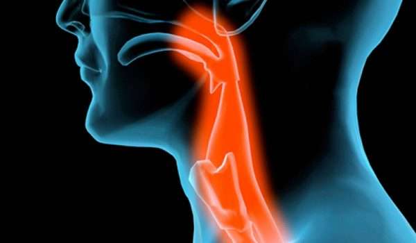 التهاب لسان المزمار Epiglottitis