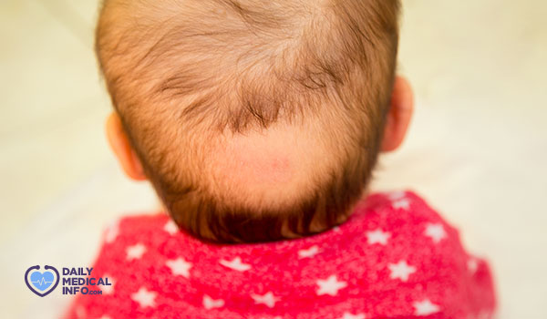 اسباب تساقط الشعر عند الاطفال