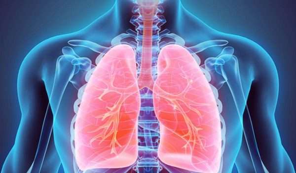 متلازمة الضائقة التنفسية الحادة ARDS