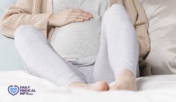 دوالي الساقين عند الحامل: الأعراض والأسباب والعلاج