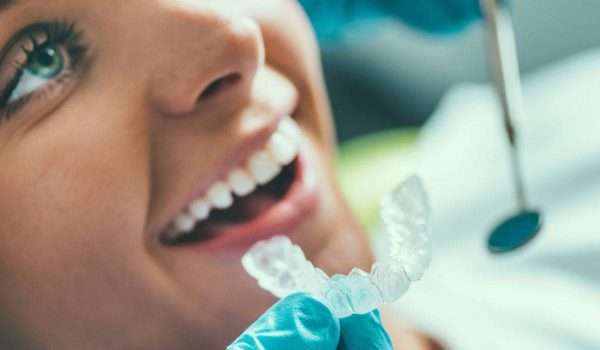 تبييض الاسنان عند الطبيب أو اسعار تبييض الاسنان
