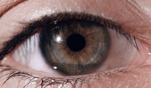 ميلانوما العين Eye melanoma