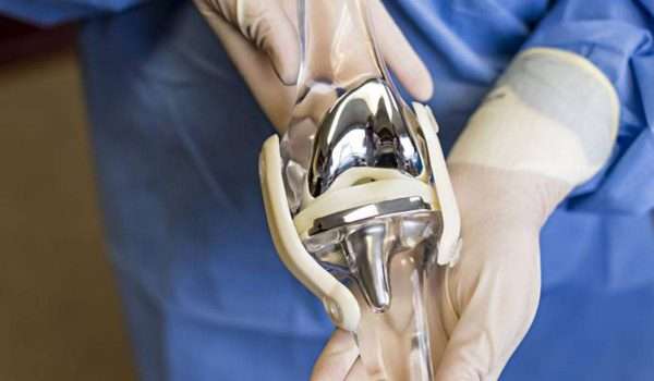 استبدال مفصل الركبة Knee replacement