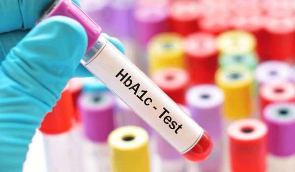 اختبار السكر التراكمي (Hemoglobin A1C Test (HbA1c