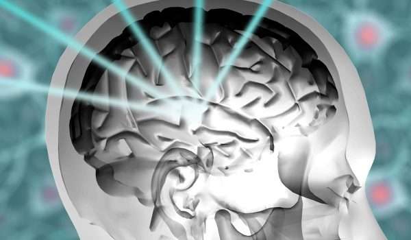 الجراحة الاشعاعية التجسيمية للدماغ Brain stereotactic radiosurgery