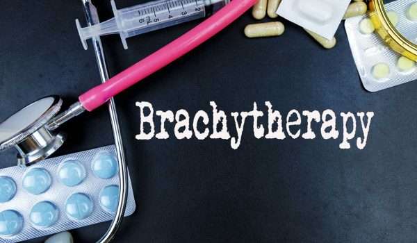 العلاج الإشعاعي الموضعي Brachytherapy