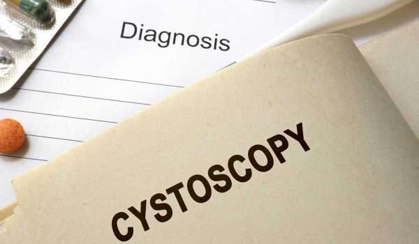 منظار المثانة Cystoscopy