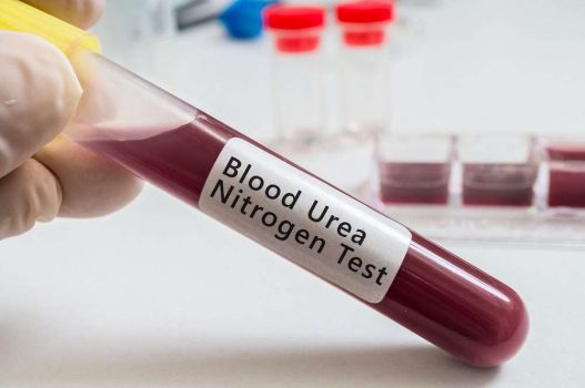 اختبار نيتروجين اليوريا في الدم