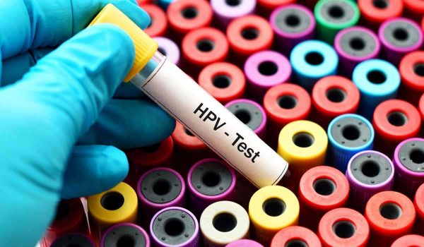 اختبار فيروس الورم الحليمي البشري HPV test