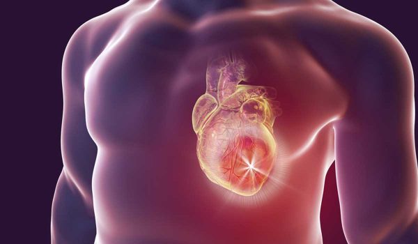 فحص الكالسيوم في الشرايين التاجية Heart coronary calcium scan