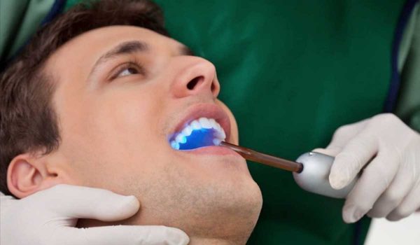علاج تسوس الاسنان بالليزر