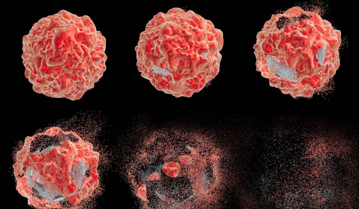 مفتاح جديد للعلماء قد يكشف سر مهم عن الخلايا السرطانية قد يمنع انتشارها