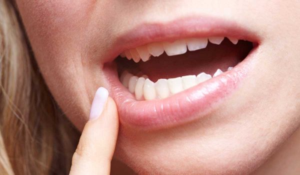 علاج ارتفاع اللثة عن الاسنان