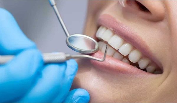 تركيب الاسنان وكل ما يتعلق به من معلومات
