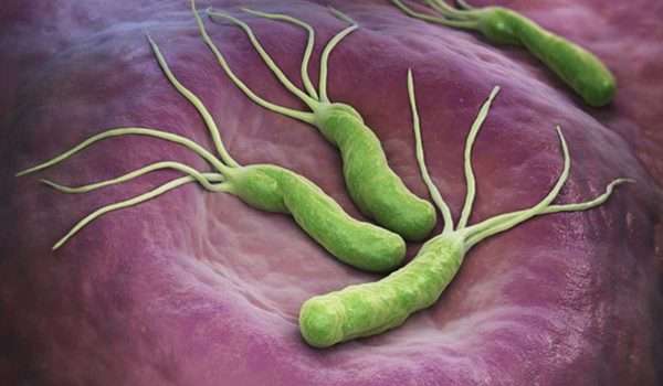 الميكروب الحلزونى “جرثومة المعدة” وحقائق هامة!