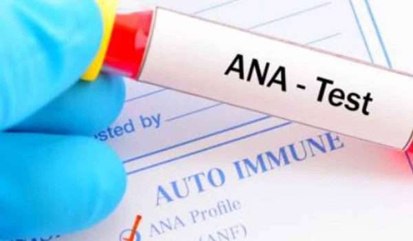 تحليل المناعة ANA وما هي نسبة المناعة الطبيعية في جسم الانسان ؟