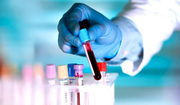 تحليل MCV لقياس حجم كريات الدم الحمراء ونتائجه