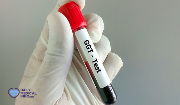 تحليل GGT – إنزيمات الكبد