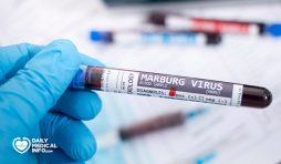 فيروس ماربورغ Marburg Virus
