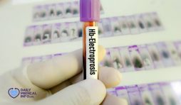 تحليل Hb Electrophoresis الفصل الكهربائي للهيموجلوبين