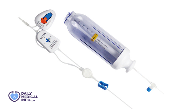 شكل جهاز PCA لتسكين الألم بعد الولادة القيصرية