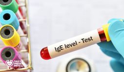 تحليل IgE (الغلوبولين المناعي) كيف يتم وما نتائجه؟