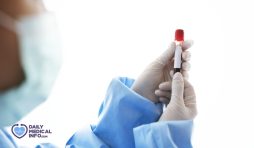 تحليل RBC لفحص كرات الدم الحمراء ونتائجه