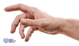 متلازمة اليد الغريبة Alien Hand Syndrome