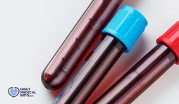 متى يظهر مرض الإيدز بتحليل الدم؟