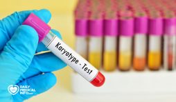 تحليل الكروموسومات Karyotyping أهميته ونتائجه