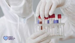تحليل كيمياء الدم Blood Chemistry Test ونتائجه