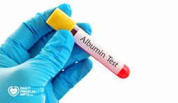 تحليل Albumin وكل ما تحتاجه من معلومات عنه