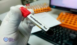 فحص السيرولوبلازمين Ceruloplasmin Test أسبابه ونتائجه