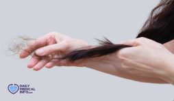 هل تساقط الشعر المزروع أمر طبيعي؟