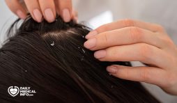 هل من الممكن علاج قشرة الشعر بسرعة؟