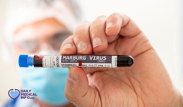 منظمة الصحة العالمية فيروس ماربورغ