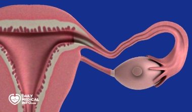 When an Ovarian Cyst Ruptures: Is It an Emergency?