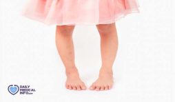 أنواع تشوهات القدم عند الأطفال